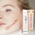 Yoxier Lavender Scar Repair Cream Acne Scar Removal Skin Stretch Pigmentation Marks Smooth Remove Scar Care Whitening Corre.