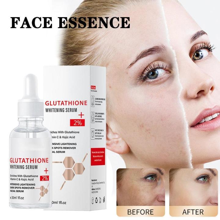 glutathione good for pcos does glutathione help with pcos Frontiers