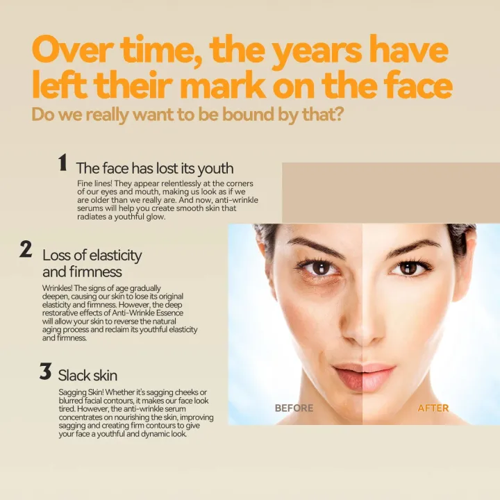 Vitamin%20C%20Facial%20Capsule%20Serum%20Moisturizing%20Anti%20Aging%20Wrinkle%20Removal%20Dark%20Spots%20Repair%20Acne%20Skin%20Rejuvenation%20Essence%20Capsules%20-%20Image%204