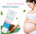 Radiant Skin Anti-Stretch Mark Miracle Cream - 60gm Enriched with Natural Ingredients for Ultimate Skin Renewal. 