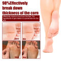 South Moon Foot Corns Exfoliating Gel Hand and Foot Wart Thorn Calluses Skin Smooth Repair and Cleaning.