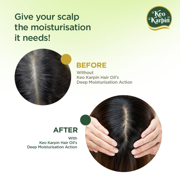 Keo%20Karpin%20Non%20Sticky%20Hair%20Oil%20Olive%20Oil%20-%20200ml%20-%20Image%203