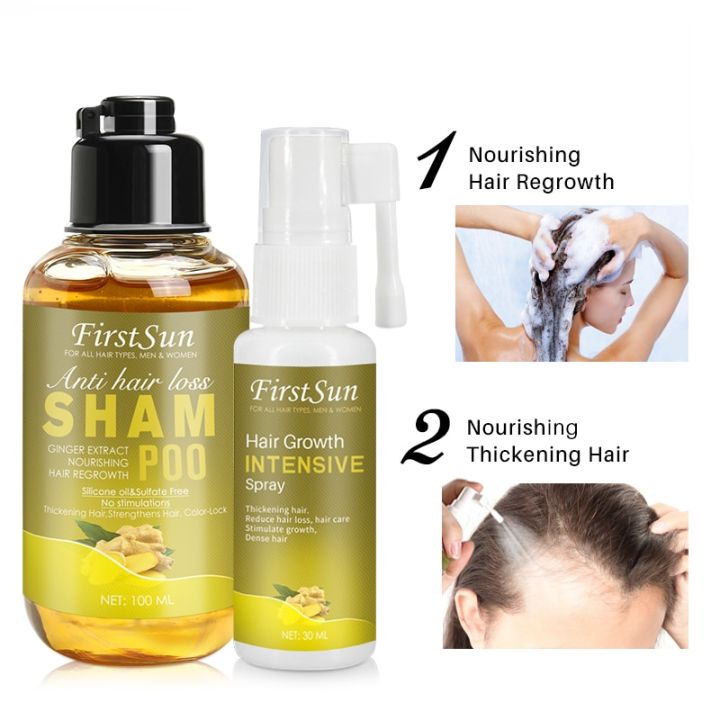 Unisex%20Anti%20Hair%20Loss%20Ginger%20Shampoo%20Hair%20Growth%20Products%20Shampoo%20Against%20Hair%20Loss%20Mild%20Treatment%20Ginger%20Shampoo%20For%20Hair%20Loss%20-%20Image%205