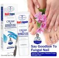 7 Day Nail Fungus Removal Cream Treatment Fungal Toe Nail Repair Gel Anti-infection Paronychia Onychomycosis Foot Care Product For Men/Women. 