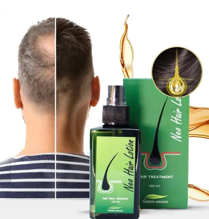 3PCS%20Natural%20Thailand%20Neo%20Hair%20Lotion%20Hair%20Care%20Oil%20Hair%20Grow%20Serum%20Essential%20Hair%20Loss%20Treatment%20Product%20Hair%20Growth%20120ML%20Lateil%20-%20Image%203