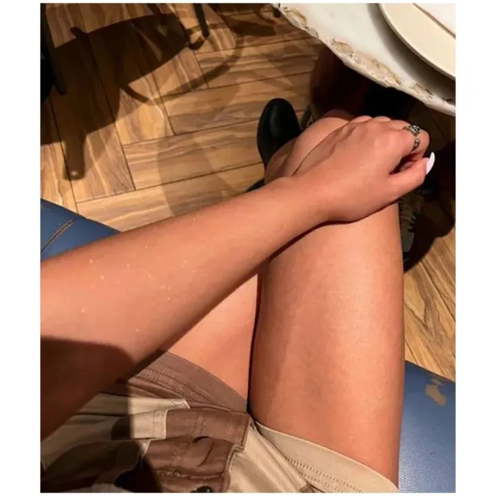 Vaseline%20200ml%20Body%20Oil%20Aloee%20Xtract%20Essence%20Skin%20Anti-wrinkle%20Vitamin%20C%20Moisturizing%20Remove%20Chicken%20Skin%20Nourish%20Care%20Product%20-%20Image%204