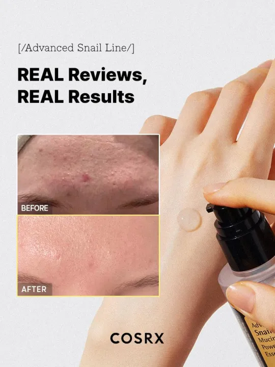 COSRX%20Authentic%20Advanced%20Snail%2096%20Mucin%20Power%20Essence%20-%20Image%206