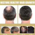 Hair Growth Cap Electric LED Red Light Therapy Hair Loss Treatment Hair Care Heating Head Massage Repair Damaged Dry Frizzy Hair. 