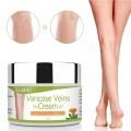 50ml Varicose Vein Ointment Remove Red Blood Streaks Veins Plaster Phlebitis Medical Cream Spider Angiitis Vasculitis Varic B5O9. 