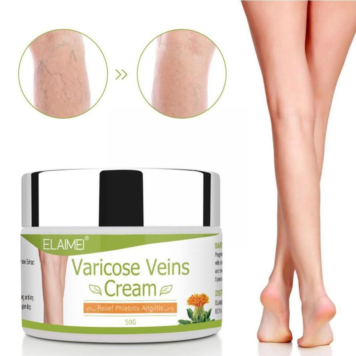 50ml%20Varicose%20Vein%20Ointment%20Remove%20Red%20Blood%20Streaks%20Veins%20Plaster%20Phlebitis%20Medical%20Cream%20Spider%20Angiitis%20Vasculitis%20Varic%20B5O9%20-%20Image%204