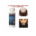 Kirkland Minoxidil 5% for Beard & Hair Growth.