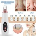Electric Vacuum Electric Acne / Blackhead Remover Extractor 6 Suction Head Beauty Machine For Skin Care. 