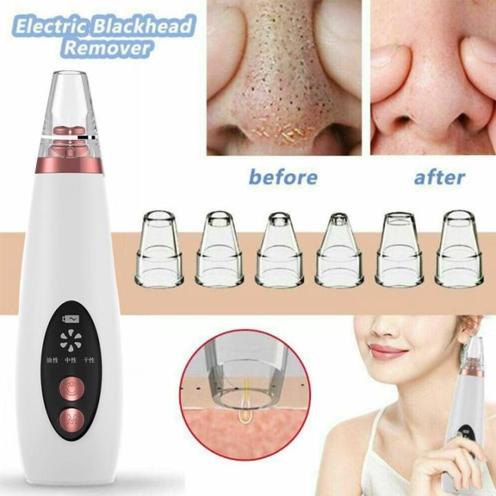Blackhead Remover Multi-function and Whitehead Remover Device oil out of your skin Cleaner Vacuum Suction Tool Rechargeable