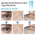2-IN-1 Auto Skin Tag Removal Kit Painless Skin Label Mole Acne Wart Removal Pen Set with Cleansing Swabs Facial Beauty Care Tool.