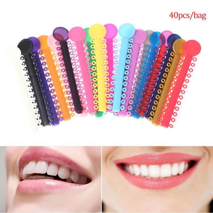 Dental%20Orthodontic%20Braces%20Elastic%20O-Ring%20Ligature%20V-Ties%20Rubber%20Bands%20Medical%20Creek%20-%20Image%203