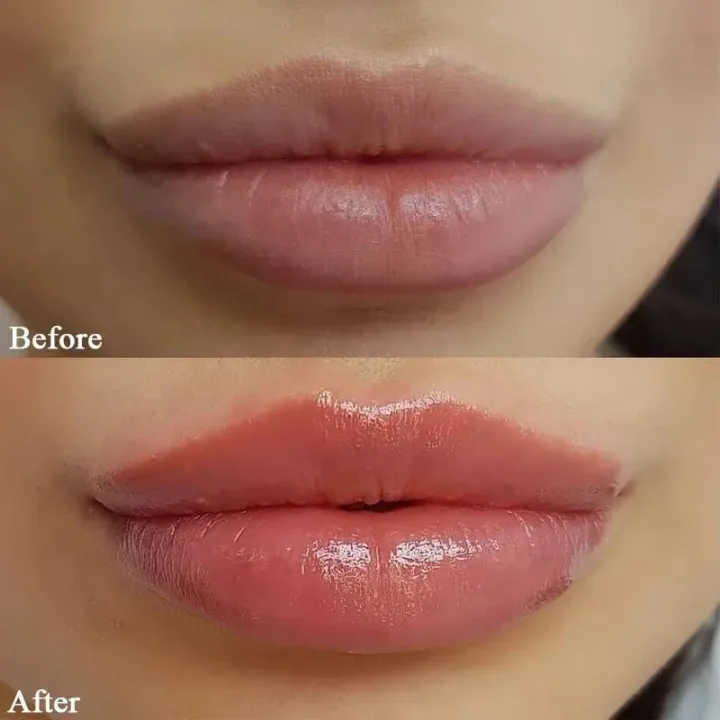 2%20Box%20Vaseline%20Lip%20Balm%20Moisturizing%20Hydrating%20Remove%20Dark%20Melanin%20Anti-Cracking%20Lipstick%20Base%20Lip%20Care%20Makeup%20Beauty%20Cosmetics%20-%20Image%204
