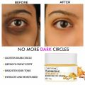 Turmeric Eye Cream Under Eye Dark Circle Remover Eye Bags Lift Firm Brightening Anti Aging Cream Eyes Care Beauty Health Abandon Abandon. 