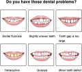 Silicone Upper/Lower False Teeth Perfect Laugh Veneers Dentures Paste Oral Hygiene Tools Teeth Instant Smile Teeth Cosmetic Lateil. 