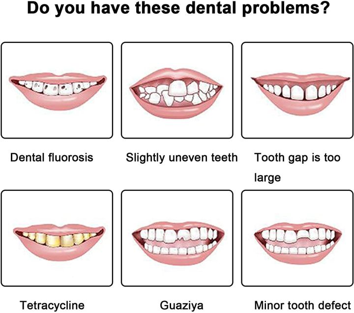 Silicone%20Upper/Lower%20False%20Teeth%20Perfect%20Laugh%20Veneers%20Dentures%20Paste%20Oral%20Hygiene%20Tools%20Teeth%20Instant%20Smile%20Teeth%20Cosmetic%20Lateil%20-%20Image%204