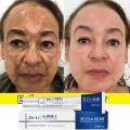Effective Whitening Freckles Cream Remove Melasma Dark Spots Fade Pigmentation Moisturize Brighten Face Korean Skin Care Product. 
