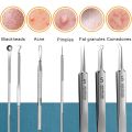 Acne Blackhead Removal Needles Pimples Blackhead Clip Tweezers Black Head Pore Cleaner Deep Cleansing Tool Face Skin Care Tool. 