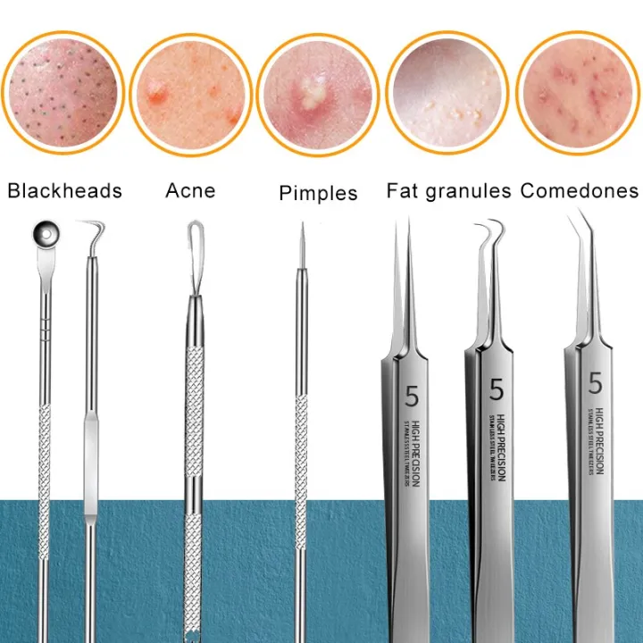 Acne%20Blackhead%20Removal%20Needles%20Pimples%20Blackhead%20Clip%20Tweezers%20Black%20Head%20Pore%20Cleaner%20Deep%20Cleansing%20Tool%20Face%20Skin%20Care%20Tool%20-%20Image%205