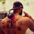 Smart Dynamic Electric Cupping Device - 5 Massage Modes with Heating Therapy, Full Body Vacuum Suction Detox Massage Machine Tools.