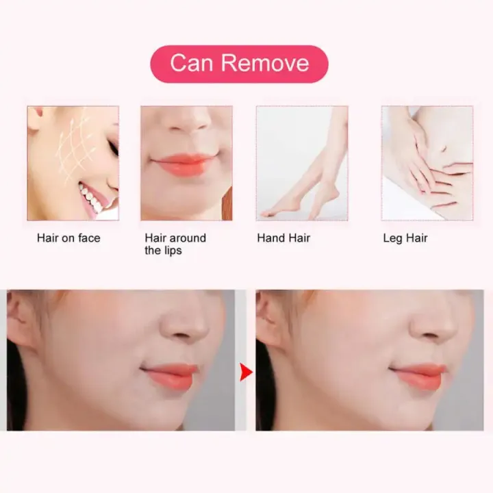 Electric%20Cotton%20Thread%20Epilator%20Lady%20Facial%20Body%20Hair%20Remover%20Rechargeable%20Pull%20Surface%20Device%20Removal%20Tool%20Face%20Depilador%20-%20Image%203