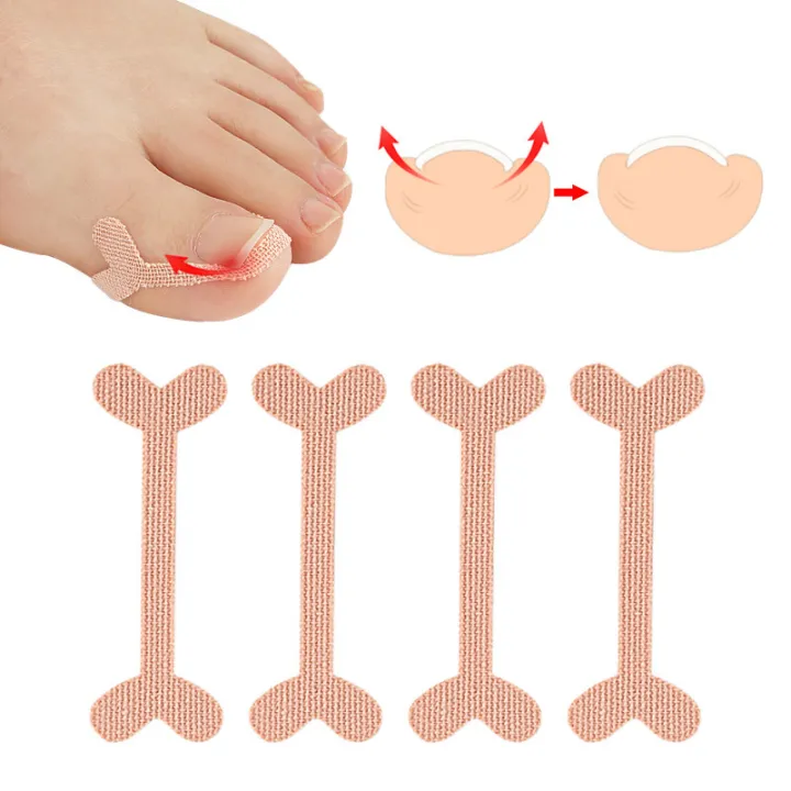 8%20Pack%20Ingrown%20Toenail%20Corrector%20Sticker%20Paronychia%20Treatment%20Fixer%20Restoration%20Pedicure%20Elastic%20Sticker%20Foot%20Toe%20Nail%20Care%20Tool%20-%20Image%209