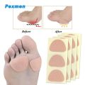 Pexmen 3/6/15Pcs Moleskin Flannel Tape Adhesive Pads Anti-wear Heel Sticker Prevent Blister Foot Pain Relief Reduce Friction Pad.
