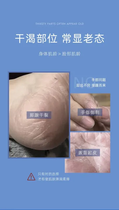 HIH%20Vaseline%20Honey%20Peach%20Real%20Moisturizing%20Cream%20Anti%20cracking%20Hand%20and%20Foot%20Heel%20Moisturizing%20Stick%20Skin%20care%20-%20Image%206