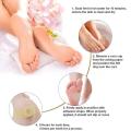 Foot Corn Removal Pen, Corn/callus Remover Liquid, Treatment Foot Genital Tag Care Skin Corn Skin Moles Remover Wart Remo G6x0.