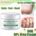 Urea 40% Cream for Dry Cracked Feet Heels Hands Body Repairing Treatment Deeply Moisturizing Callus Dead Skin Remove Foot Care.