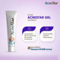 AcneStar Gel - Acne, Pimples Control Gel | 22g | Made in INDIA. 