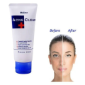 Mistine Acne Clear Facial Foam 85g. 