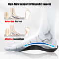 Orthotic Insoles for Plantar Fasciitis Pain Relief Therapy Flat Feet Arch Support Insoles for Shoes Women Men XO-Legs Corrector. 