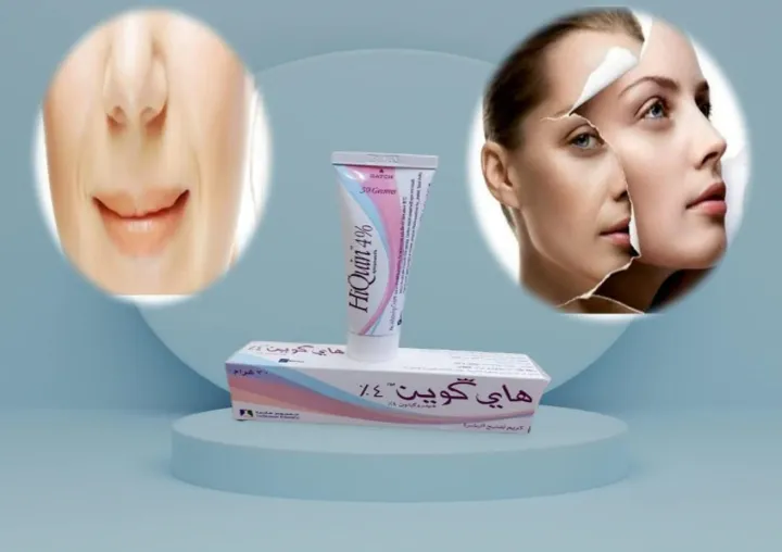 HIQUIN%204%25%20CREAM%2030GM%20-%20Image%203