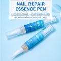 Repair Nail Fungus Treatments Essence Foot Care Serum Toe Nails Fungal Removal Gel Anti-Infection Onychomycosis Nail Care 4ml. 