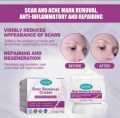 Scar Removal Cream Repairing Damaged Skin Reducing Scars And Smoothing The Skin 50g, কাটা ও পুড়ে যাওয়ার দাগ স্কিন থেকে মুছে ফেলুন। মুখমন্ডল, হাত, পা, বডি অথবা স্কিনের যেকোনো যায়গাতে ব্যবহার করতে পারবেন, #lazbinstore. 