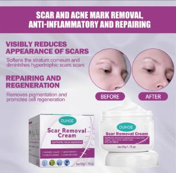 Scar%20Removal%20Cream%20Repairing%20Damaged%20Skin%20Reducing%20Scars%20And%20Smoothing%20The%20Skin%2050g,%20%E0%A6%95%E0%A6%BE%E0%A6%9F%E0%A6%BE%20%E0%A6%93%20%E0%A6%AA%E0%A7%81%E0%A7%9C%E0%A7%87%20%E0%A6%AF%E0%A6%BE%E0%A6%93%E0%A7%9F%E0%A6%BE%E0%A6%B0%20%E0%A6%A6%E0%A6%BE%E0%A6%97%20%E0%A6%B8%E0%A7%8D%E0%A6%95%E0%A6%BF%E0%A6%A8%20%E0%A6%A5%E0%A7%87%E0%A6%95%E0%A7%87%20%E0%A6%AE%E0%A7%81%E0%A6%9B%E0%A7%87%20%E0%A6%AB%E0%A7%87%E0%A6%B2%E0%A7%81%E0%A6%A8%E0%A5%A4%20%E0%A6%AE%E0%A7%81%E0%A6%96%E0%A6%AE%E0%A6%A8%E0%A7%8D%E0%A6%A1%E0%A6%B2,%20%E0%A6%B9%E0%A6%BE%E0%A6%A4,%20%E0%A6%AA%E0%A6%BE,%20%E0%A6%AC%E0%A6%A1%E0%A6%BF%20%E0%A6%85%E0%A6%A5%E0%A6%AC%E0%A6%BE%20%E0%A6%B8%E0%A7%8D%E0%A6%95%E0%A6%BF%E0%A6%A8%E0%A7%87%E0%A6%B0%20%E0%A6%AF%E0%A7%87%E0%A6%95%E0%A7%8B%E0%A6%A8%E0%A7%8B%20%E0%A6%AF%E0%A6%BE%E0%A7%9F%E0%A6%97%E0%A6%BE%E0%A6%A4%E0%A7%87%20%E0%A6%AC%E0%A7%8D%E0%A6%AF%E0%A6%AC%E0%A6%B9%E0%A6%BE%E0%A6%B0%20%E0%A6%95%E0%A6%B0%E0%A6%A4%E0%A7%87%20%E0%A6%AA%E0%A6%BE%E0%A6%B0%E0%A6%AC%E0%A7%87%E0%A6%A8,%20#lazbinstore%20-%20Image%206
