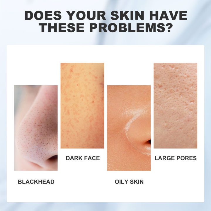 Mud%20Mask%20for%20Face%20Dead%20Sea%20Remove%20Pimples%20Blackhead%20Purifying%20Mild%20Hydrating%20Cleansing%20Anti%20Acne%20Marks%20Lighten%20Melanin%20Clay%20Care%20-%20Image%204