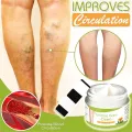 Varicose Veins Cream.