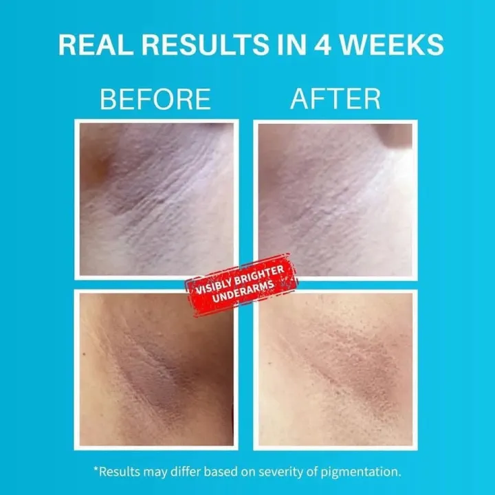 Dermdoc%20Underarm%20Treatment%20Spray,%205%25%20Glycolic%20Acid%20-100%20ml%20-%20Image%206