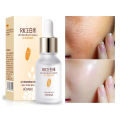 ROREC White Rice Serum Best For Pores & Moisturizing - 15ml (100% Authentic). 