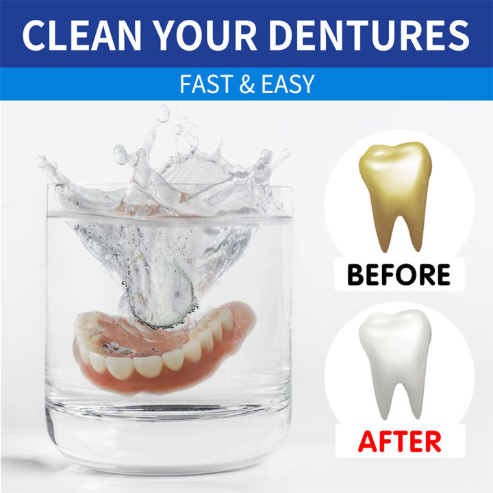 Jaysuing%20Denture%20Cleaning%20Tablets%20Removes%20Odor%20Stains%20%7C%20Oral%20Retainer%20Cleaner%20for%20Aligners%20Teeth%20Capped%20Cleaning%20Tablet%20100PCS%20-%20Image%203