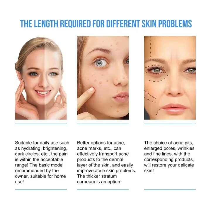 MRS%20140-A%20Needles%20Adjustable%20Anti-Aging%20Dermastamp%20Roller%20with%20Anti-Slip%20ABS%20Handle%20and%20Stainless%20Steel%20Needles%20for%20Face%20Therapy%20-%20Image%208