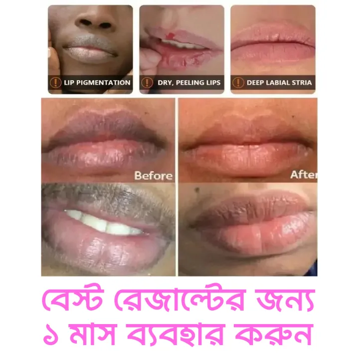 ELHOE%20Baby%20Pink%20Drop:%20Best%20Lip,%20Nipple%20&%20Skin%20Whitening%20Serum.%20Get%20a%20Natural%20Rosy%20Pink%20Glow%20for%20Lips%20&%20Nipples.%20Buy%20Now%20-%20Image%204