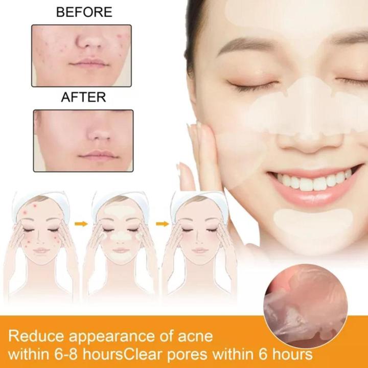 Hydrocolloid%20Acne%20Face%20Mask%20-%205%20Large%20Pimple%20Patches%20For%20Zit%20Breakouts%20On%20Nose,%20Chin,%20Forehead%20And%20Cheeks%2010pcs/box%20R7L7%20-%20Image%206
