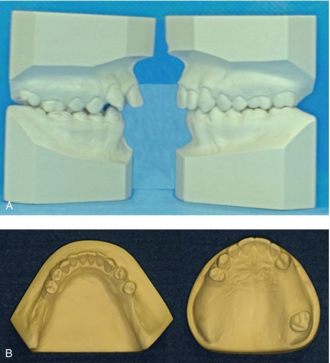 Plaster%20Of%20Paris%20/%20Gypsum%20Powder%20For%20Dental%20Modeling,%20Medical%20Casting%20-%20Image%206