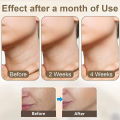 Facial Lifting Device EMS Neck Facial Eye Massage Face Slimmer Skin Tighten Wrinkle Anti Aging Face Massager Double Chin Remover.